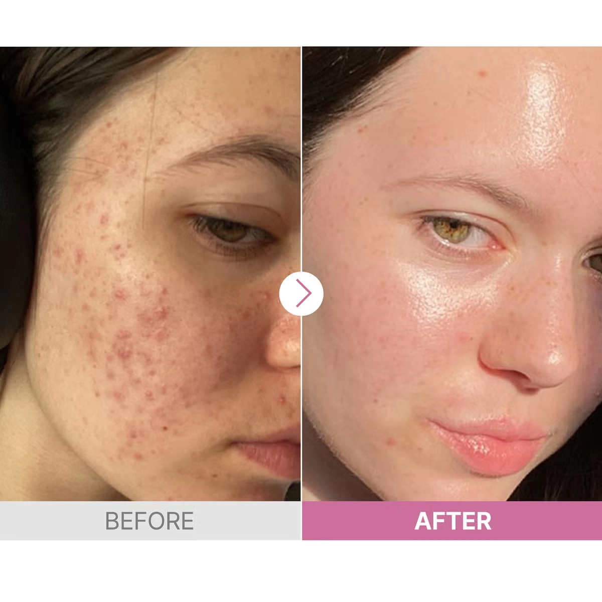 Cosrx The Niacinamide 15 sivorotkasi onlayn