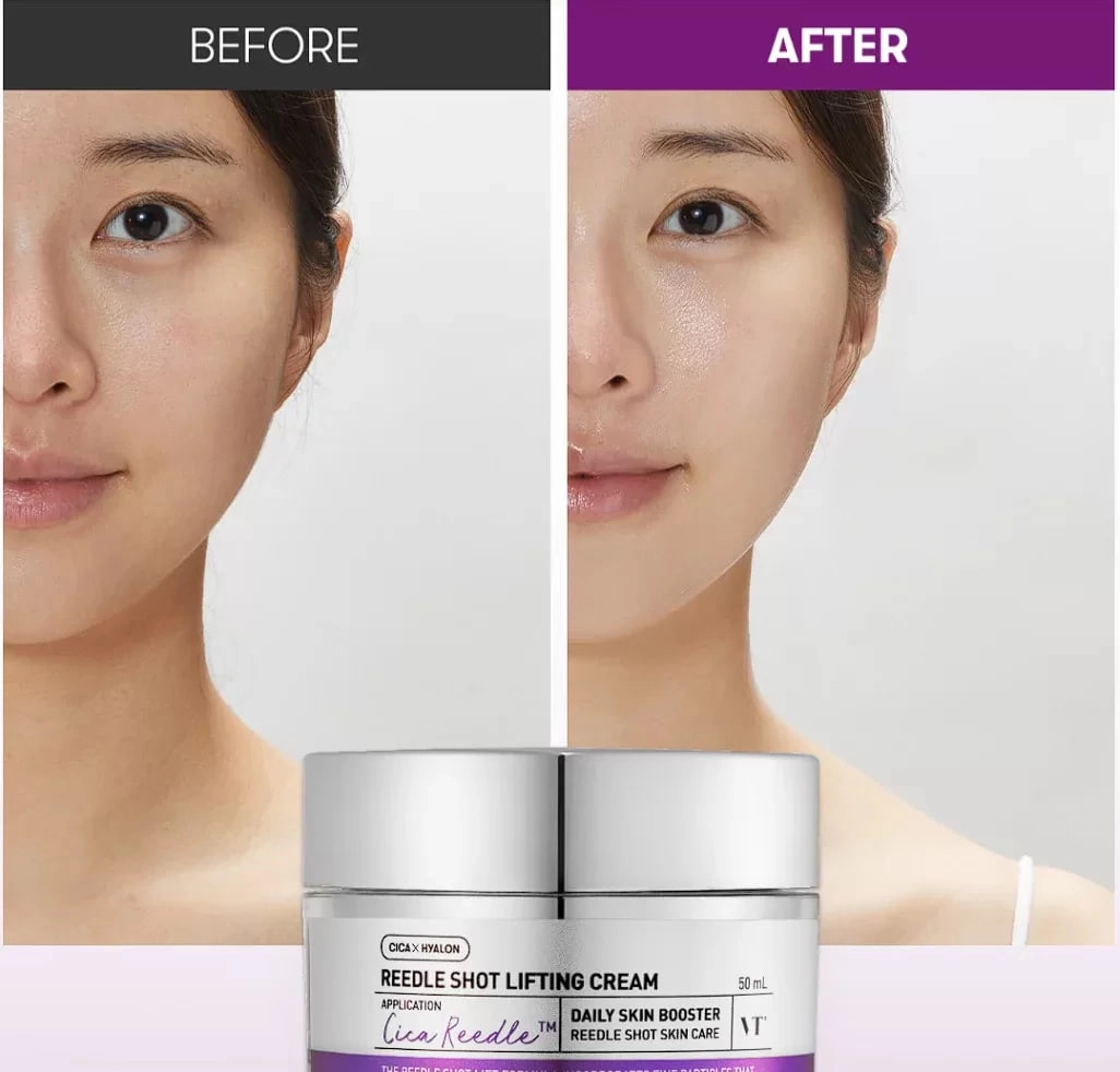 VT Cosmetics Cream Reedle Shot Lifting 50 ml- yuz uchun krem O'zbekistonda