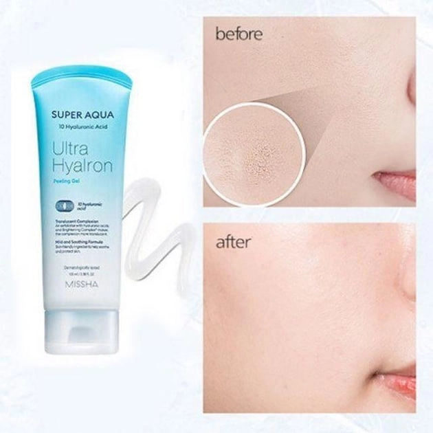 Пилинг-гель для лица - Missha  Super Aqua Peeling Gel онлайн