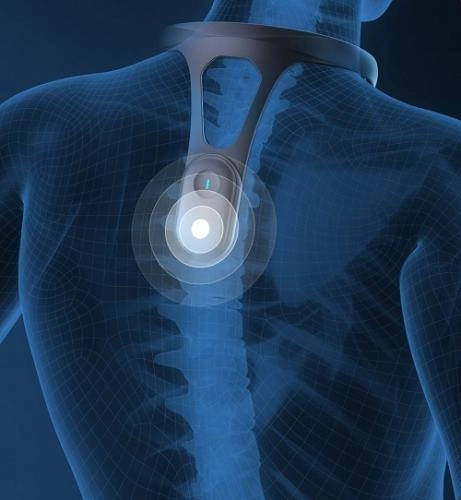 Умный корректор осанки Xiaomi Hipee Smart Posture Correction Wizard онлайн