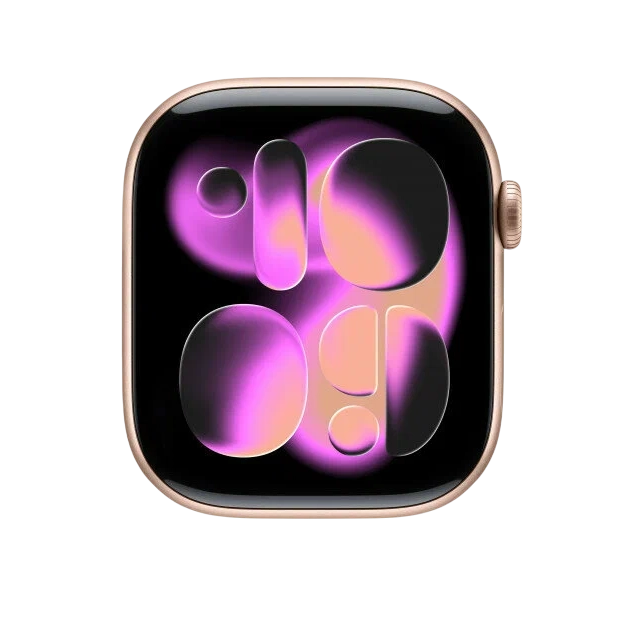 Смарт часы Apple Watch Series 11 Aluminum case 46 мм, Rose Gold недорого